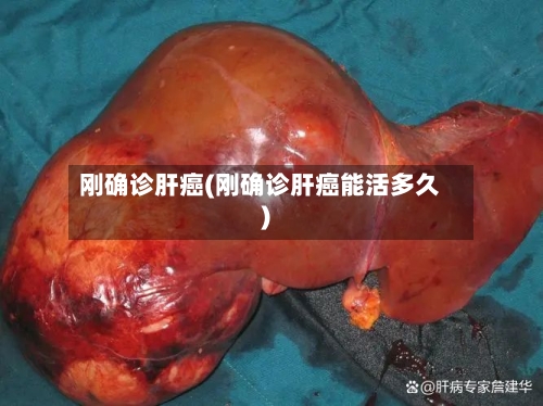 刚确诊肝癌(刚确诊肝癌能活多久)