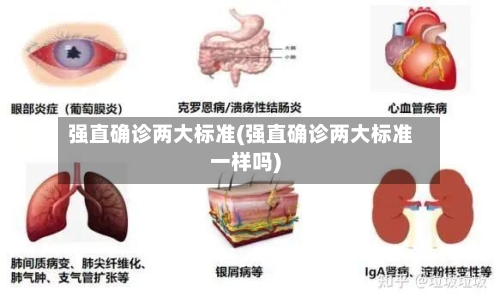 强直确诊两大标准(强直确诊两大标准一样吗)