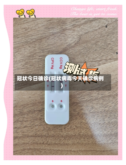 冠状今日确诊(冠状病毒今天确诊病例)