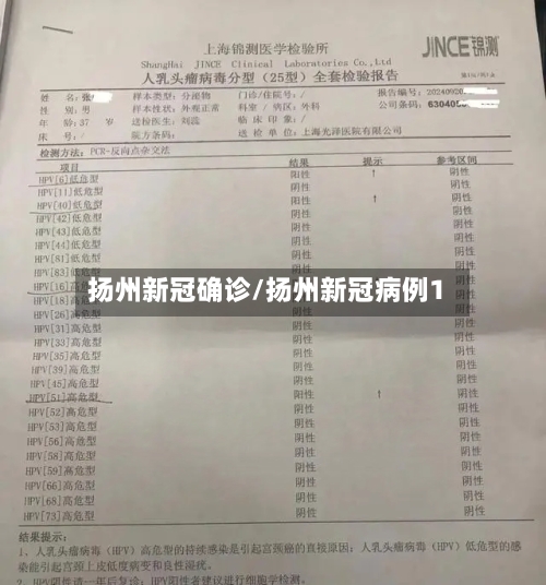 扬州新冠确诊/扬州新冠病例1