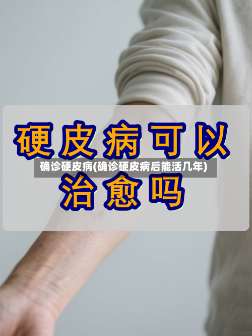 确诊硬皮病(确诊硬皮病后能活几年)