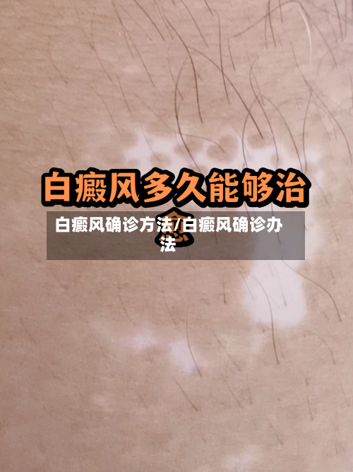 白癜风确诊方法/白癜风确诊办法