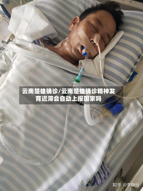 云南楚雄确诊/云南楚雄确诊精神发育迟滞会自动上报国家吗