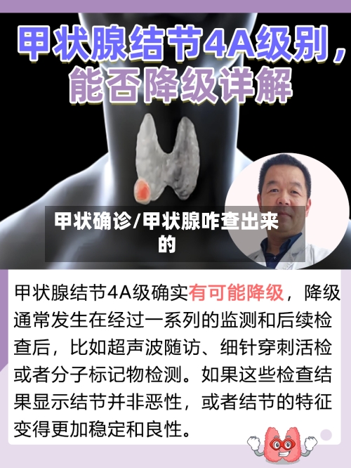 甲状确诊/甲状腺咋查出来的