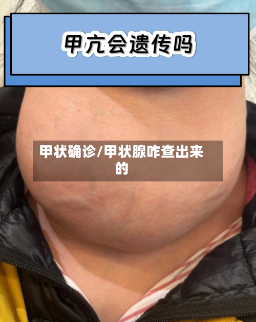 甲状确诊/甲状腺咋查出来的