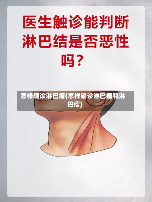 怎样确诊淋巴瘤(怎样确诊淋巴瘤和淋巴瘤)