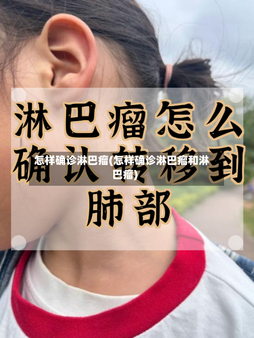 怎样确诊淋巴瘤(怎样确诊淋巴瘤和淋巴瘤)
